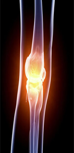 Knee Restoration Surgery Knee Restoration Surgery